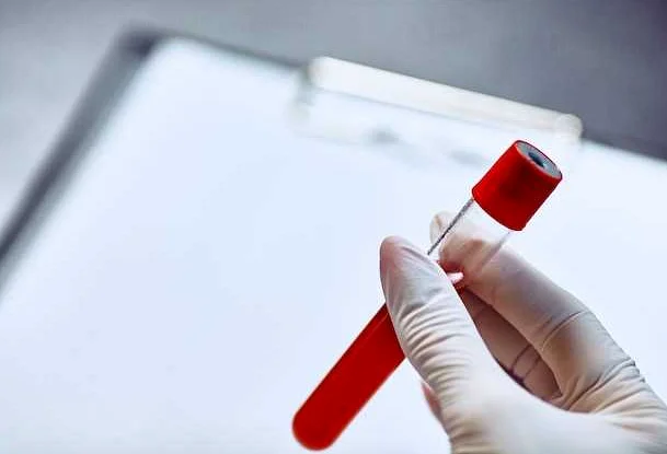 Как проводится анализ крови ИФА?