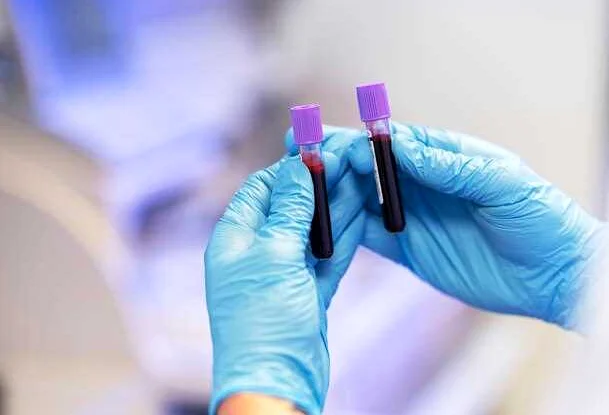 С реактивный белок в анализе крови: его роль и значение