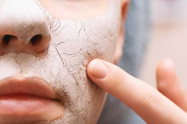 Как избавиться от псориаза – советы для чувствительной кожи