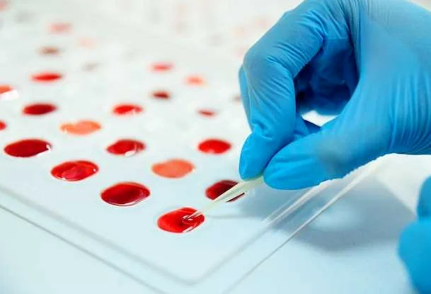 Правописание слова 'лейкоциты' в анализе крови