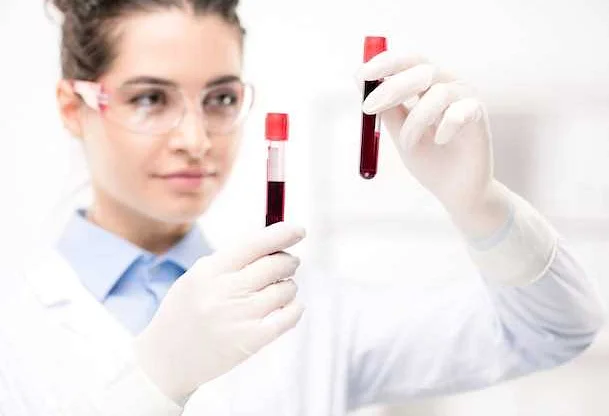 Правила сдачи анализа на мочевую кислоту в крови: подготовка и доставка