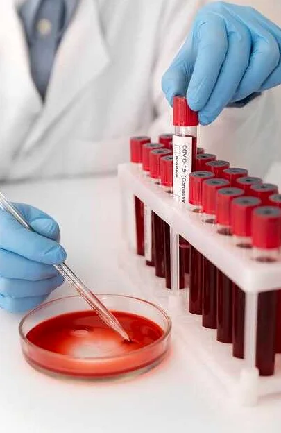 Сдача крови на анализ: список инфекций, которые можно выявить