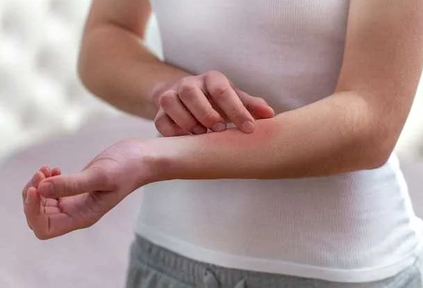 Аллергическая крапивница: причины и факторы развития