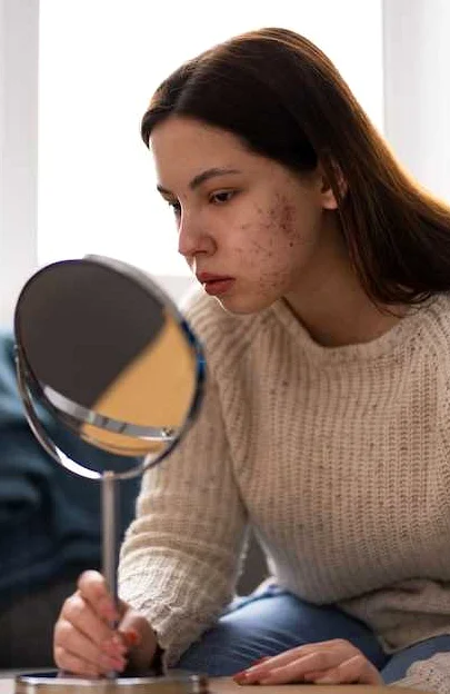 Способы устранения шершавости кожи на лице