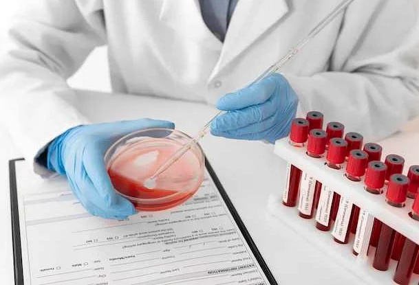 Как долго длится анализ крови в клиниках ИНВИТРО?